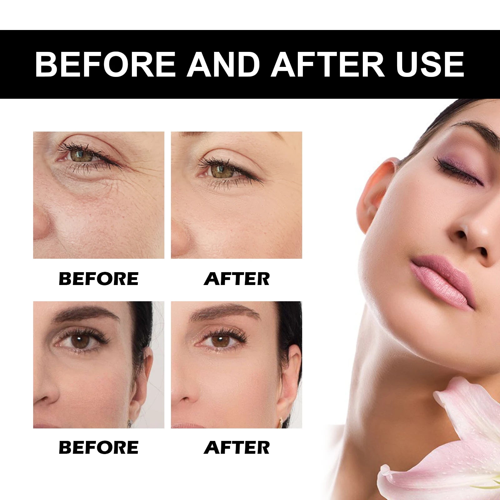 Vitamin C Serum For Face Dark Spot Removal